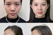 提升照片清晰度的技巧（以探索如何让照片更清晰）
